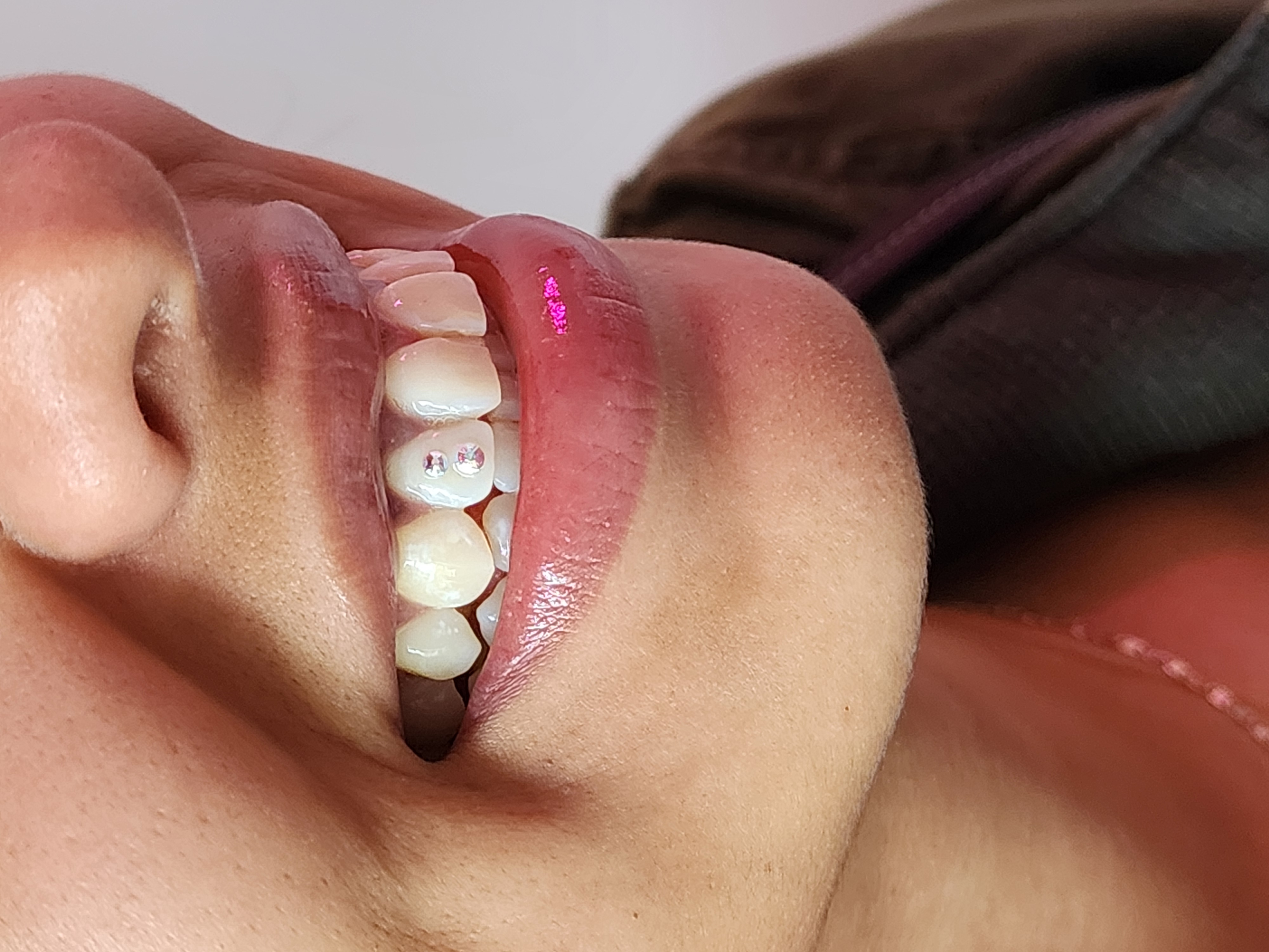 Tooth Gems